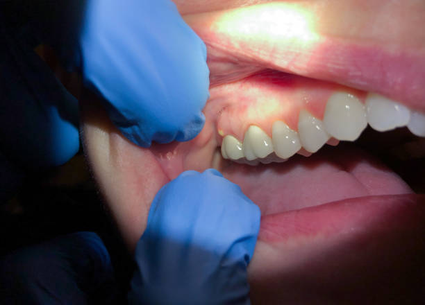 Reliable CA Emergency Dental Service Solutions