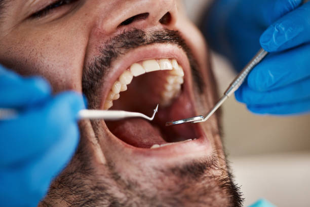 Best Emergency Denture Repair in Hanford, CA
